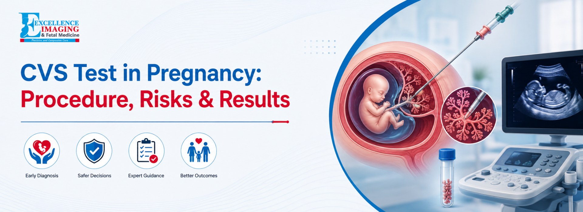 CVS test in pregnancy banner showing chorionic villus sampling procedure with ultrasound guidance, placenta cell collection, fetal imaging, and prenatal genetic testing illustration at Excellence Imaging and Fetal Medicine