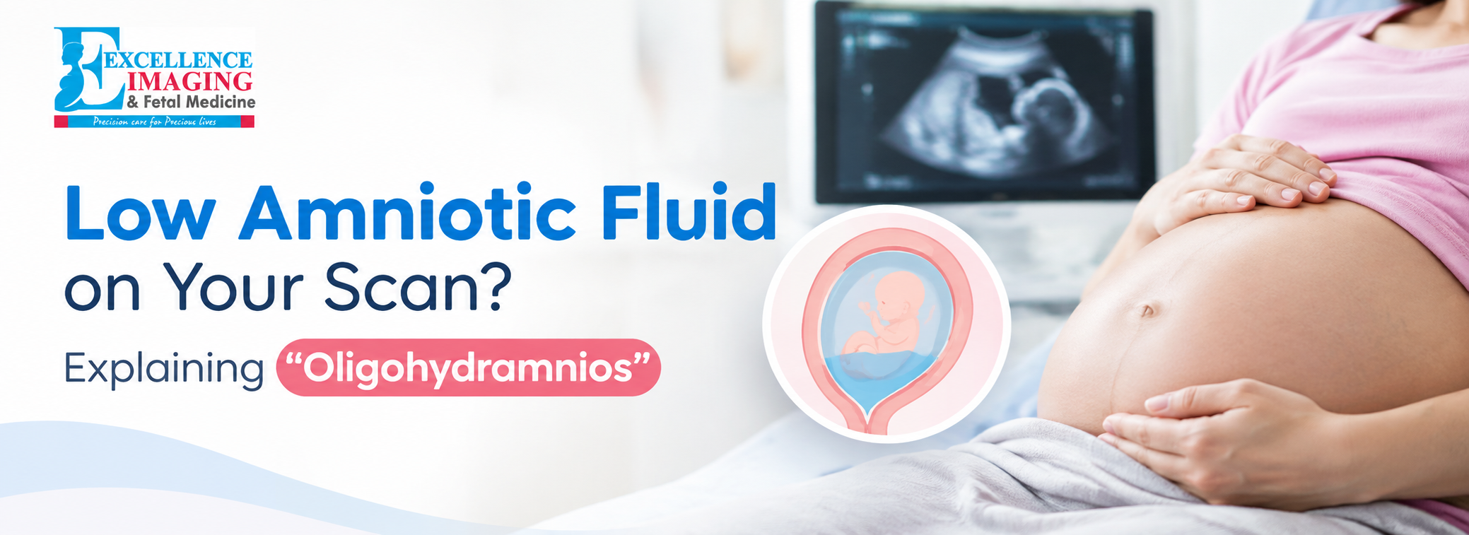 Planning an anomaly scan? Know the best time for your 20 week scan, what it checks, how to prepare, what happens after the scan, and what to do next.